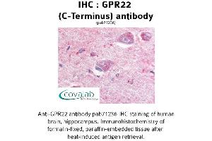 Image no. 1 for anti-G Protein-Coupled Receptor 22 (GPR22) (C-Term), (Cytoplasmic Domain) antibody (ABIN1735032)