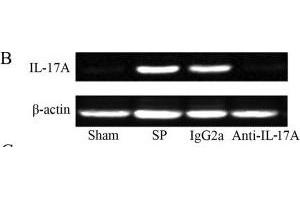 anti-Interleukin 17A (IL17A) antibody