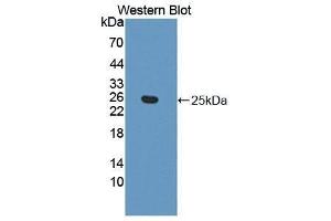 anti-Ephrin A5 (EFNA5) (AA 21-203) antibody