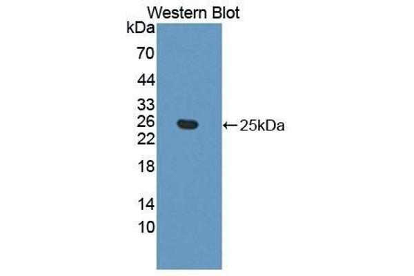 anti-Ephrin A5 (EFNA5) (AA 21-203) antibody