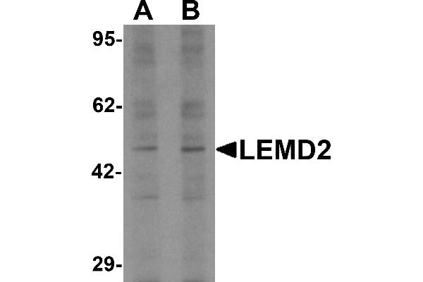 LEMD2 antibody  (Middle Region)