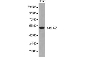 Image no. 1 for anti-Sphingomyelin phosphodiesterase 2, Neutral Membrane (Neutral Sphingomyelinase) (SMPD2) antibody (ABIN3021605)