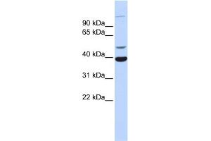 Image no. 1 for anti-Zinc Finger Protein 124 (ZNF124) (Middle Region) antibody (ABIN2776394)