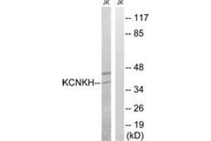 Image no. 1 for anti-Potassium Channel, Subfamily K, Member 17 (KCNK17) (AA 271-320) antibody (ABIN1535186)