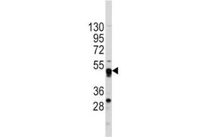 Image no. 3 for anti-GATA Binding Protein 4 (GATA4) (AA 298-328) antibody (ABIN3031033)