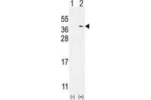 Image no. 3 for anti-NME Gene Family Member 9 (NME9) (AA 111-140), (Middle Region) antibody (ABIN955405)