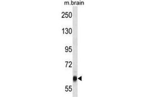 Image no. 1 for anti-Vacuolar Protein Sorting 45 (VPS45) (AA 460-489), (C-Term) antibody (ABIN955526)