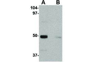 Image no. 1 for anti-Interleukin 34 (IL34) (Internal Region) antibody (ABIN6656230)