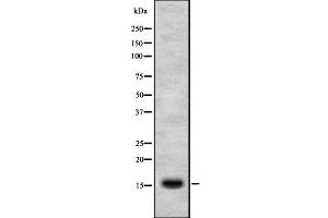 Image no. 1 for anti-Jumping Translocation Breakpoint (JTB) antibody (ABIN6262711)