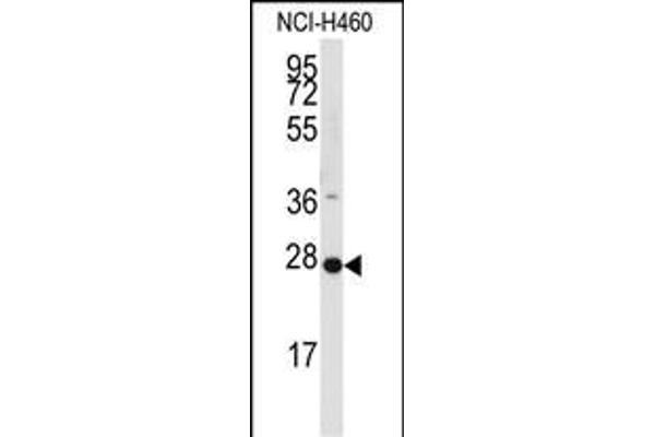 PPAP2C Antikörper  (C-Term)