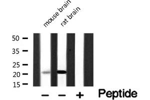 Image no. 1 for anti-Calcium And Integrin Binding Family Member 2 (CIB2) (Internal Region) antibody (ABIN6260836)