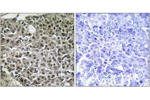 NFATC4 antibody  (AA 642-691)