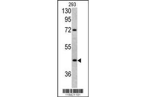 Image no. 2 for anti-Leucine-Rich alpha-2 Glycoprotein 1 (LRG1) (AA 194-223) antibody (ABIN390660)