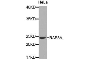 Image no. 1 for anti-RAB8A, Member RAS Oncogene Family (RAB8A) antibody (ABIN1874520)
