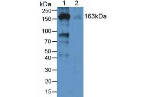 Image no. 4 for alpha-2-Macroglobulin (A2M) ELISA Kit (ABIN6574110)