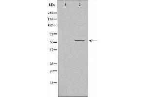Image no. 1 for anti-RAR-Related Orphan Receptor C (RORC) (Internal Region) antibody (ABIN6259177)