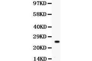Image no. 1 for anti-Kallikrein-Related Peptidase 4 (KLK4) (AA 31-254) antibody (ABIN3042476)