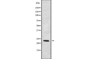 Image no. 2 for anti-RAB6B, Member RAS Oncogene Family (RAB6B) (Internal Region) antibody (ABIN6264588)
