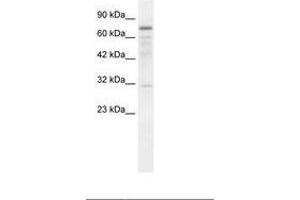 Image no. 1 for anti-tRNA Methyltransferase 1 (TRMT1) (AA 418-467) antibody (ABIN202857)