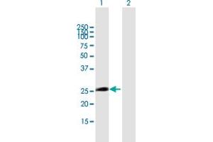 Western Blot analysis of ITGB1BP3 expression in transfected 293T cell line by ITGB1BP3 MaxPab polyclonal antibody.