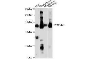 Image no. 1 for anti-Phosphatidylinositol Transfer Protein, Membrane-Associated 1 (PITPNM1) antibody (ABIN6567755)