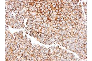 IHC-P Image Immunohistochemical analysis of paraffin-embedded PC13 xenograft, using GGT1, antibody at 1:100 dilution.