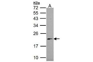 Image no. 6 for anti-NADH Dehydrogenase (Ubiquinone) 1 beta Subcomplex, 5, 16kDa (NDUFB5) (C-Term) antibody (ABIN2856830)