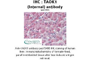 Image no. 2 for anti-TAO Kinase 1 (TAOK1) (Internal Region) antibody (ABIN1739900)