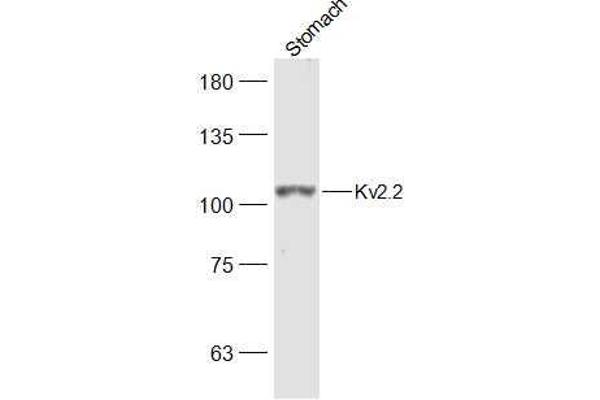 Kv2.2 antibody  (AA 21-120)