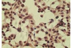 Image no. 2 for anti-Cylindromatosis (Turban Tumor Syndrome) (CYLD) (AA 32-45) antibody (ABIN200017)