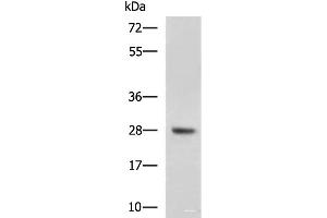 Western blot analysis of Mouse liver tissue lysate using DHRS2 Polyclonal Antibody at dilution of 1:800
