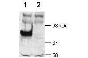 Image no. 1 for anti-Disabled Homolog 1 (Drosophila) (DAB1) (AA 400-555), (C-Term) antibody (ABIN6657863)