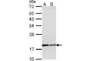 Image no. 2 for anti-ADP-Ribosylation Factor 1 (ARF1) (Center) antibody (ABIN2856896)