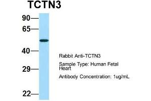 Image no. 1 for anti-Tectonic Family Member 3 (TCTN3) (Middle Region) antibody (ABIN2781966)