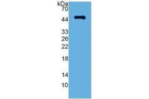 Image no. 2 for Leucine-Rich alpha-2 Glycoprotein 1 (LRG1) ELISA Kit (ABIN6730983)