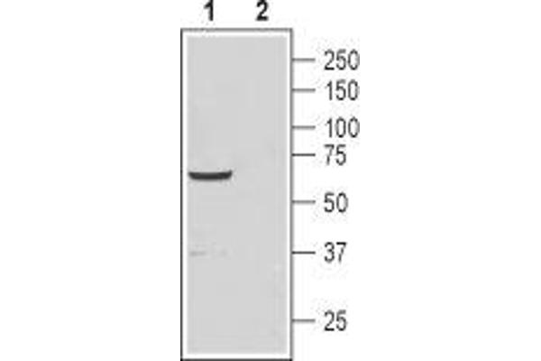anti-Cation Channel, Sperm Associated 4 (CATSPER4) (1st Extracellular Loop), (AA 90-105) antibody