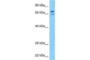 Image no. 1 for anti-Potassium Voltage-Gated Channel, Shal-Related Subfamily, Member 3 (KCND3) (C-Term) antibody (ABIN5515524)