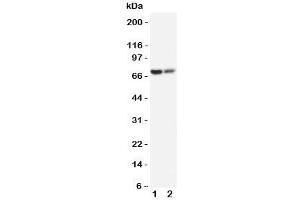 Image no. 3 for anti-ATP-Binding Cassette, Sub-Family D (Ald), Member 3 (ABCD3) (C-Term) antibody (ABIN3030056)