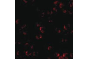 Image no. 1 for anti-Kinesin Family Member 5A (KIF5A) (C-Term) antibody (ABIN6656247)