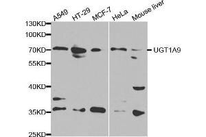 Image no. 2 for anti-UDP Glucuronosyltransferase 1 Family, Polypeptide A9 (UGT1A9) antibody (ABIN3022343)