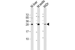 Image no. 2 for anti-Caudal Type Homeobox 1 (CDX1) antibody (ABIN1882223)