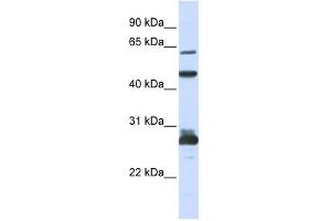 Image no. 1 for anti-Pescadillo Ribosomal Biogenesis Factor 1 (PES1) antibody (ABIN631680)