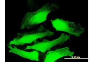 Immunofluorescence of purified MaxPab antibody to DNAJC5 on HeLa cell.