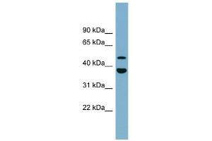 Image no. 1 for anti-Chromosome 4 Open Reading Frame 20 (C4orf20) (Middle Region) antibody (ABIN632121)