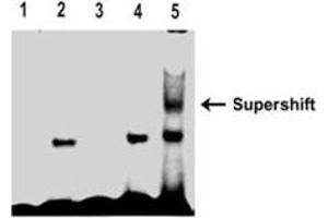 Image no. 2 for Runt-Related Transcription Factor 1 (RUNX1) (Transcript Variant 2) (Active) protein (Myc-DYKDDDDK Tag) (ABIN2731253)