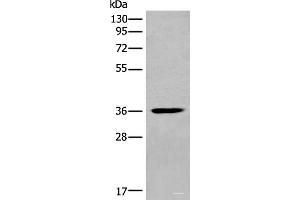 Western blot analysis of Mouse heart tissue lysate using MEDAG Polyclonal Antibody at dilution of 1:700