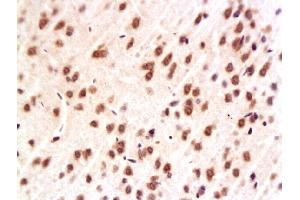 Image no. 2 for anti-Mitogen-Activated Protein Kinase 1/3 (MAPK1/3) (AA 301-358) antibody (ABIN723725)