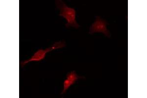 Image no. 4 for anti-Mitogen-Activated Protein Kinase Kinase Kinase 7 (MAP3K7) (pThr187) antibody (ABIN6256492)