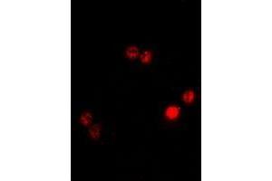 Image no. 2 for anti-Actin-Like 6B (ACTL6B) (full length) antibody (ABIN6043116)