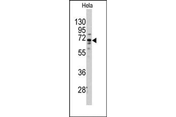 anti-Frizzled Family Receptor 1 (Fzd1) (AA 374-404), (Middle Region) antibody